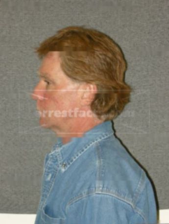 Ronald G Peterson