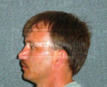 Matthew J Boileau