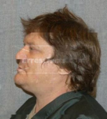 Keith B Eschmann