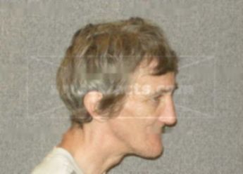 James D Bricco