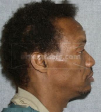 Raymond Coleman