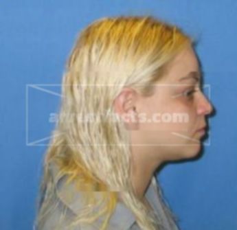 Amber M Chamless