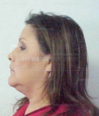 Lesli J Silvers