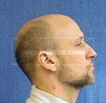 William Miessner