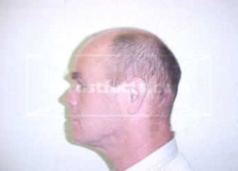 Martin L Coleman
