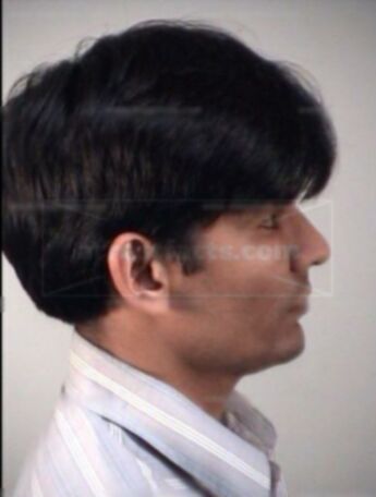 Tarun Patel