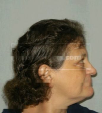 Kathleen M Burt