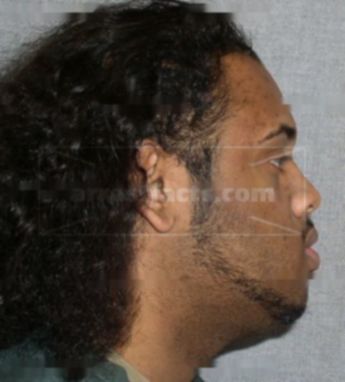 Marquis D Walls