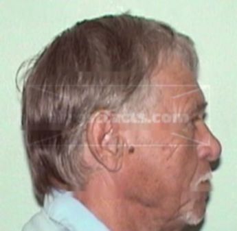 Alvin C. Sievert