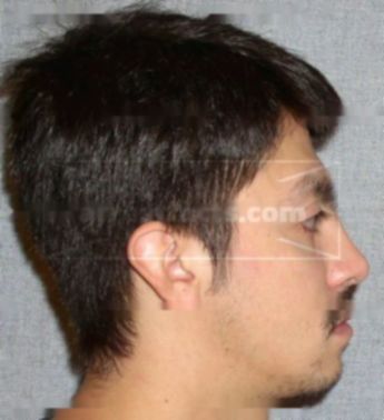 Ricardo Zunigaruiz