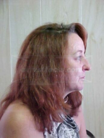 Carol A Maddox