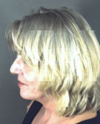 Laura Synek Braeunig