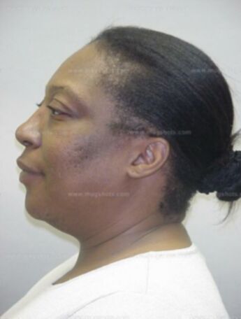 Susan A Mcghee