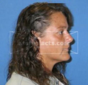 Sandra L Dicus