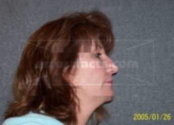Amy R Dettloff