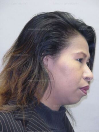 Xap P Nguyen