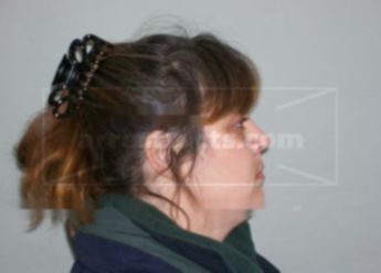 Teresa M Karlinsky
