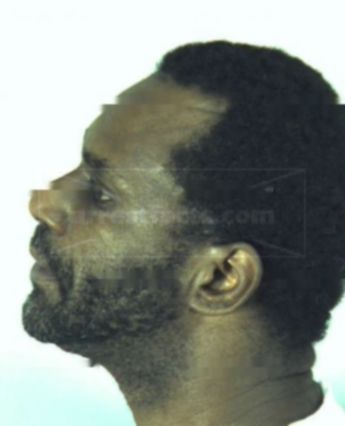 Darryl Glenn Lane
