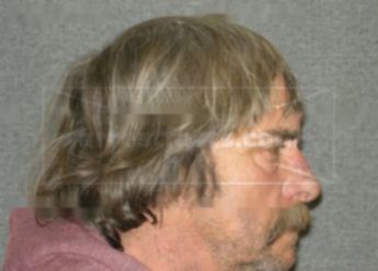 Lee M Severson