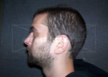 Joseph B Greene