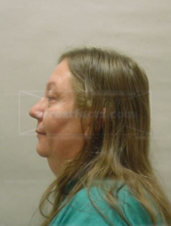 Darlene M Brandenburg
