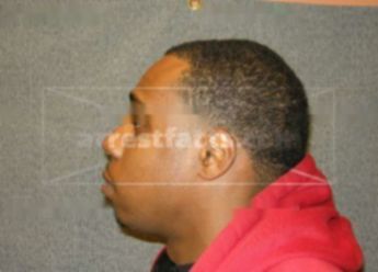 Hassan J Lewis