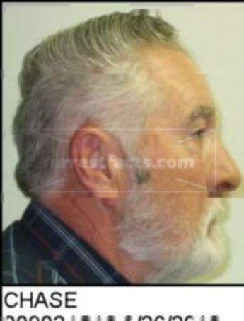 Melvin Keith Chase