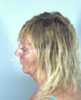 Dana Amos Weedon