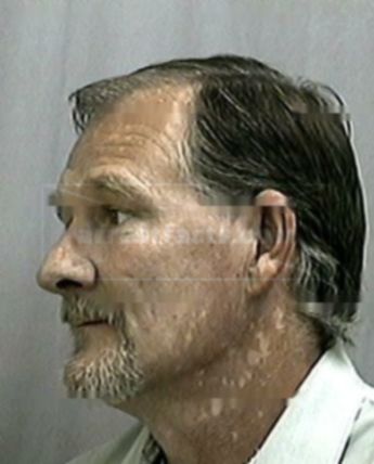 Thomas D Garrison