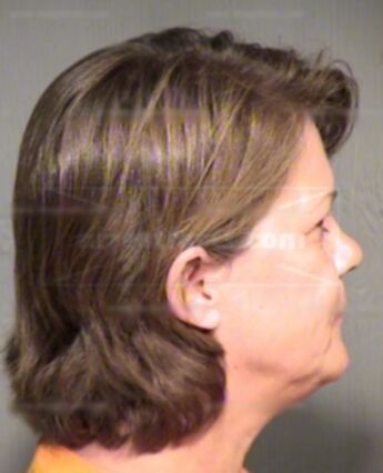 Lynda Kathleen Dawson