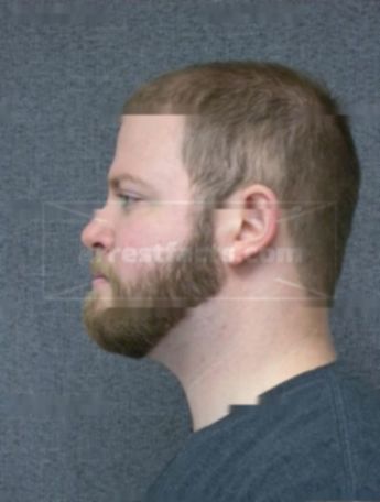 Jacob M Syphard