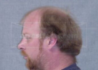 Randy D Belling