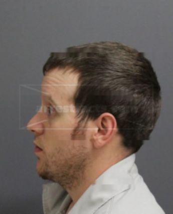 Charles Winthrop Zocher