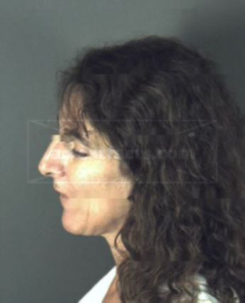 Robin Lynn Blank