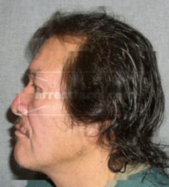 Gary M Kaquatosh