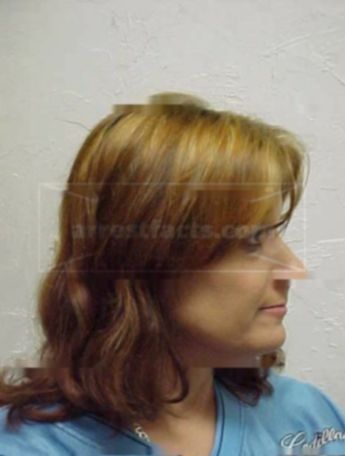 Kathy Link