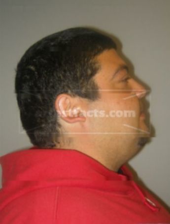 Robert A Quinones