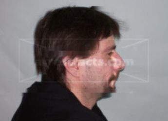 Todd M Sterk