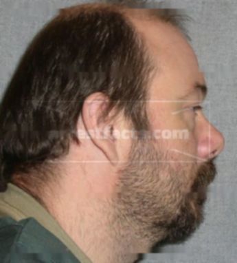 Jason Klein