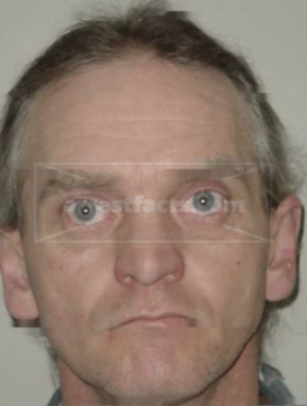 Lyle D Fischer