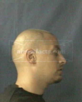 Anthony M Fox
