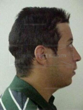 Mario A Beltran