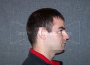 Joshua L Erickson