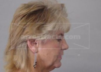 Linda L Gordon