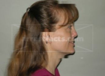 Terriesa G Roth