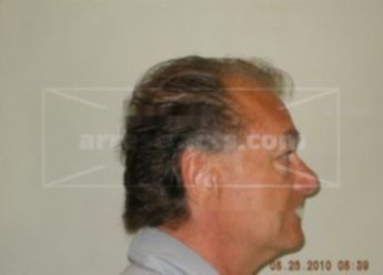 Timothy Schuette