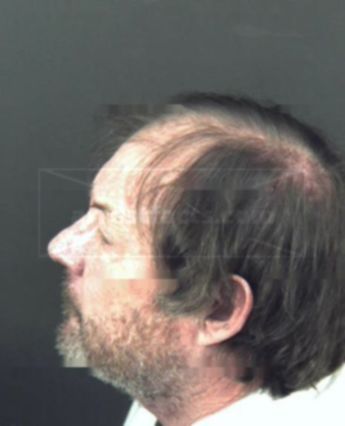 Donald Lee Pursley