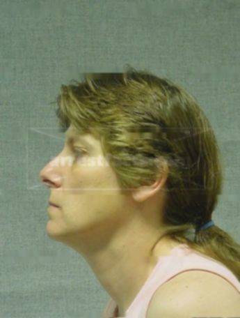Teresa M Karas