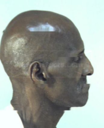Hubert B Brown