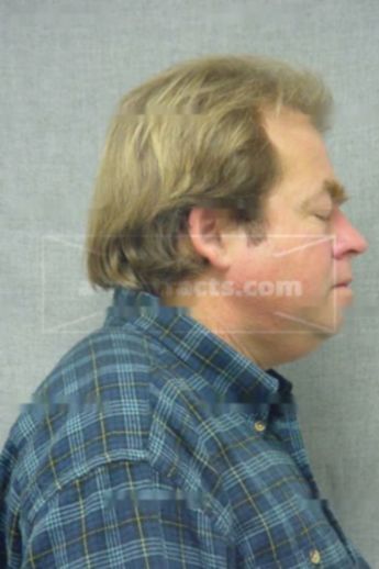 Steven H Borhart